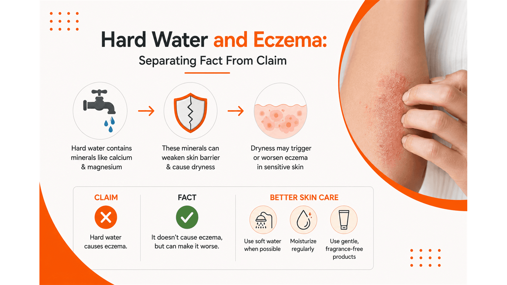 Hard Water and Eczema: Separating Fact From Claim